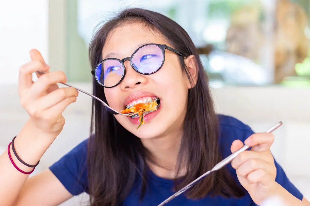 how-to-eat-after-getting-braces