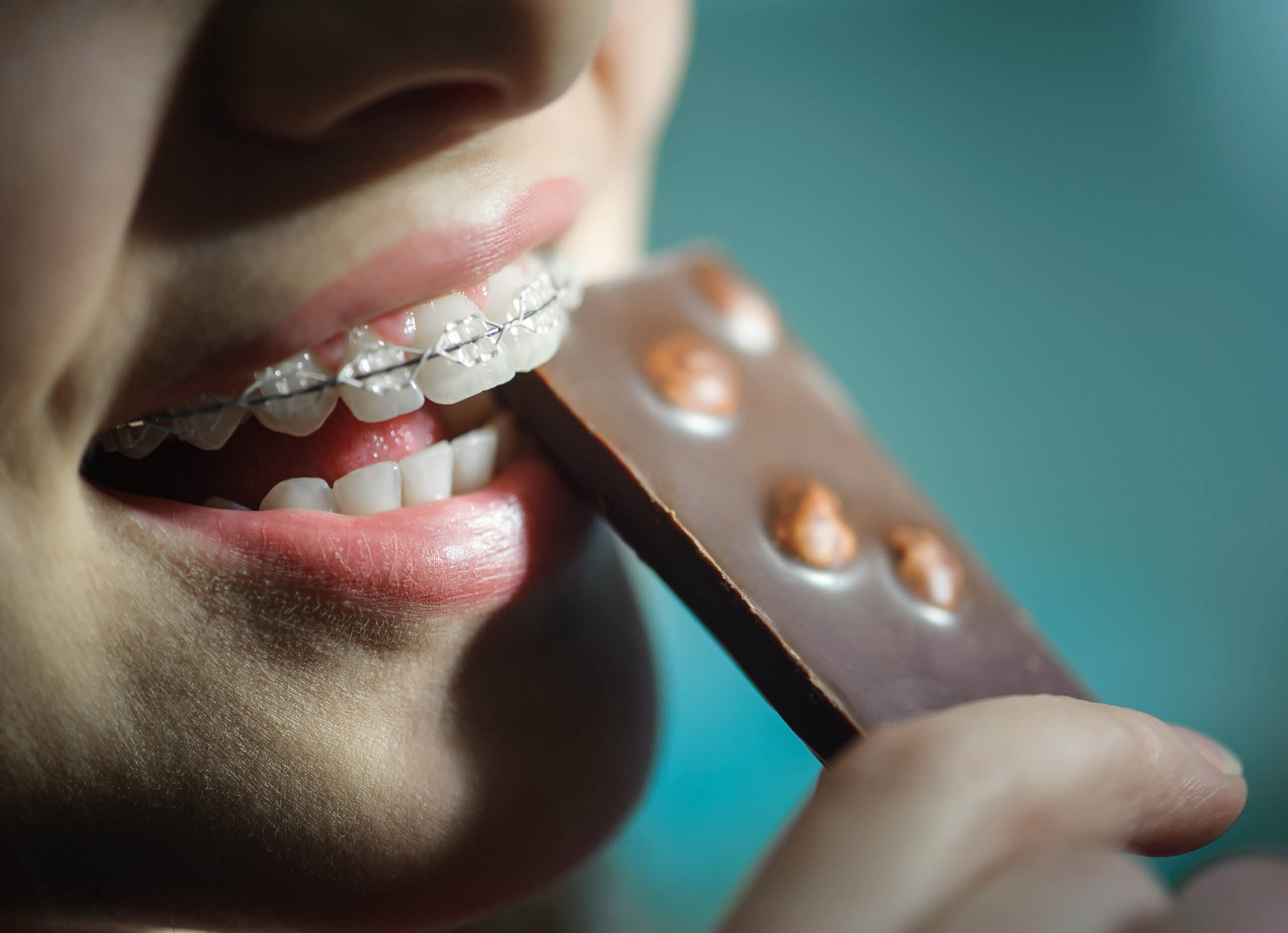 how-to-eat-with-braces-without-pain